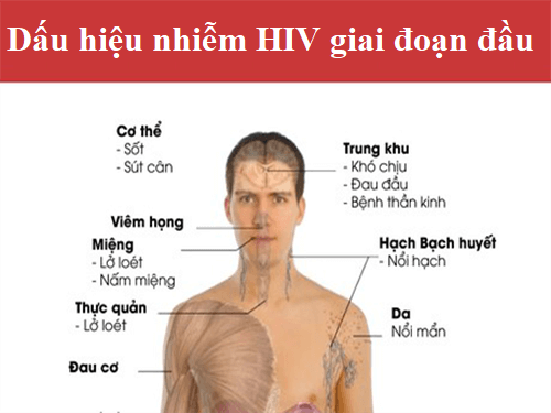Triệu chứng bệnh HIV